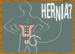 illustration: hernias play-by-play